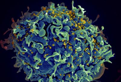 Third HIV cure reported