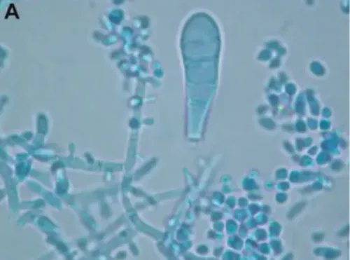 BREAKING: First case of TMVII confirmed in Washington, say health officials