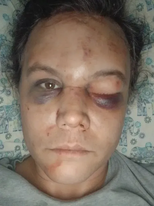 Justice for Nikki Armstrong: A Transgender woman’s story of assault, survival, and perseverance